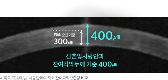 잔여각막두께 기준 비교(미국 FDA 승인기준 300㎛ · 신촌 빛사랑안과 400㎛)
