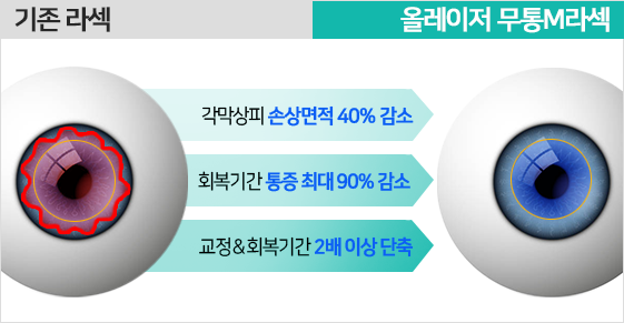 기존 라섹과 올레이저 무통 M 라섹 비교
