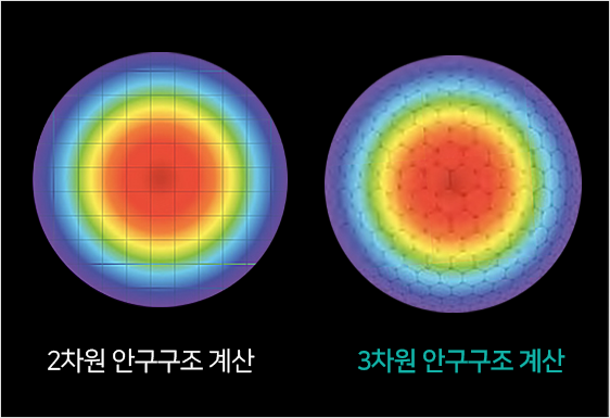 2차원 안구구조 계산과 3차원 안구구조 계산 비교