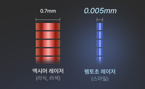 엑시머 레이저(라식·라섹)와 펨토초 레이저(스마일) 비교