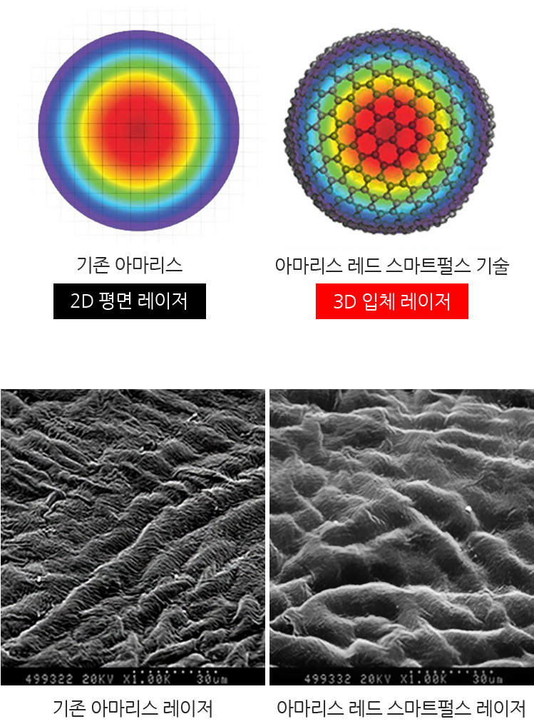 기존 아마리스와 아마리스 레드 스마트펄스 기술 비교