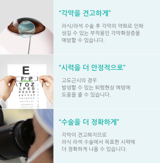 엑스트라 시행 여부에 따른 각막 상태 비교