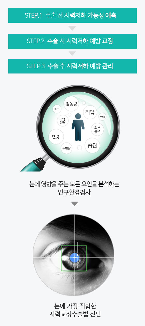 안구 검사