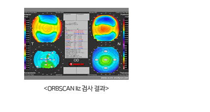 Auto Ref-Keratometer 검사 결과