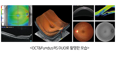 OCT&Fundus RS-DUO 촬영 모습