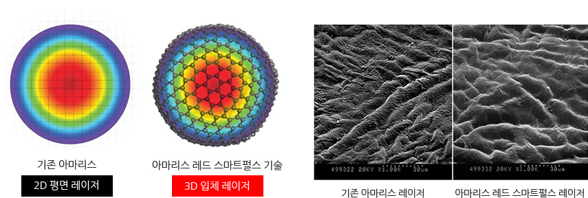 기존 아마리스와 아마리스 레드 스마트펄스 기술 비교