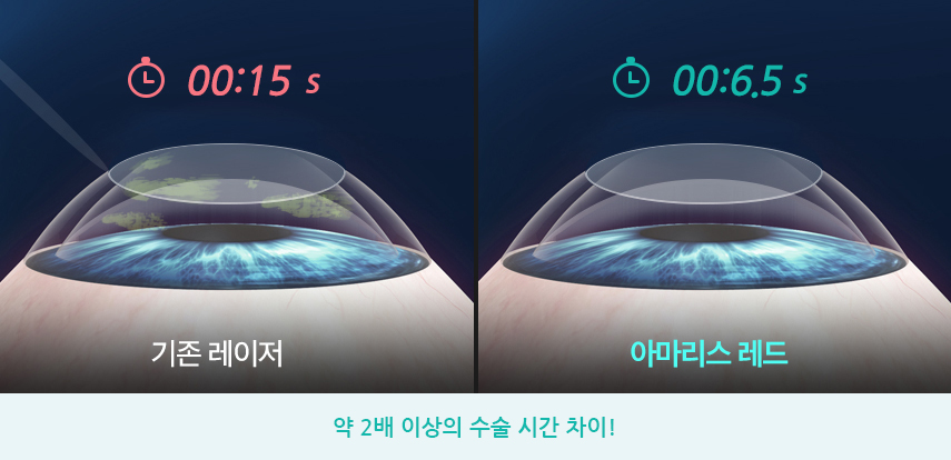 기존 레이저와 아마리스 레드의 수술 시간 비교