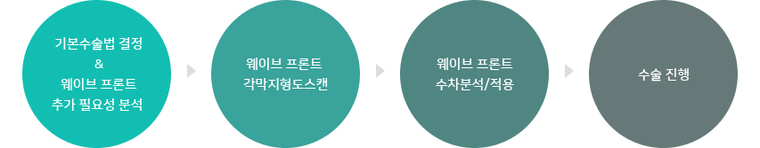 웨이브 프론트 라식·라섹 수술 과정 4단계