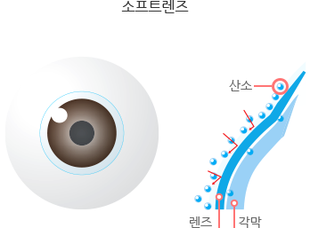 소프트렌즈의 산소 투과