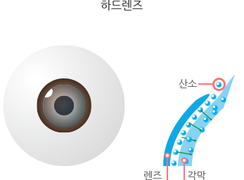 하드렌즈의 산소 투과