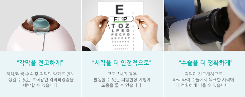엑스트라 시행 여부에 따른 각막 상태 비교