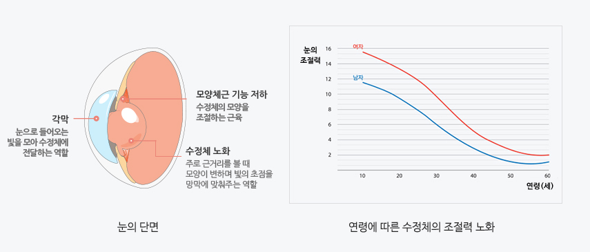 눈의 단면