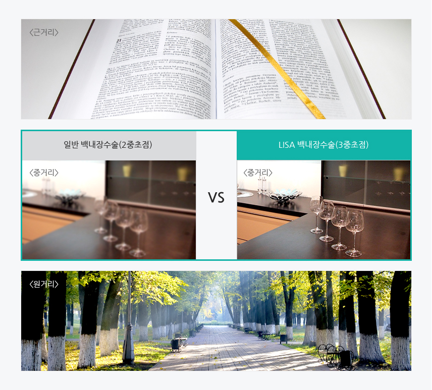 투명한시야 확보 + 근,중,원거리 시력 향상