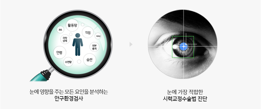 안구 검사 범위