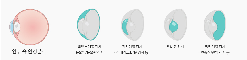 눈의내부환경분석